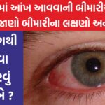 eye conjunctivitis