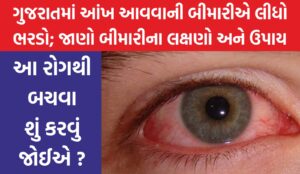 eye conjunctivitis