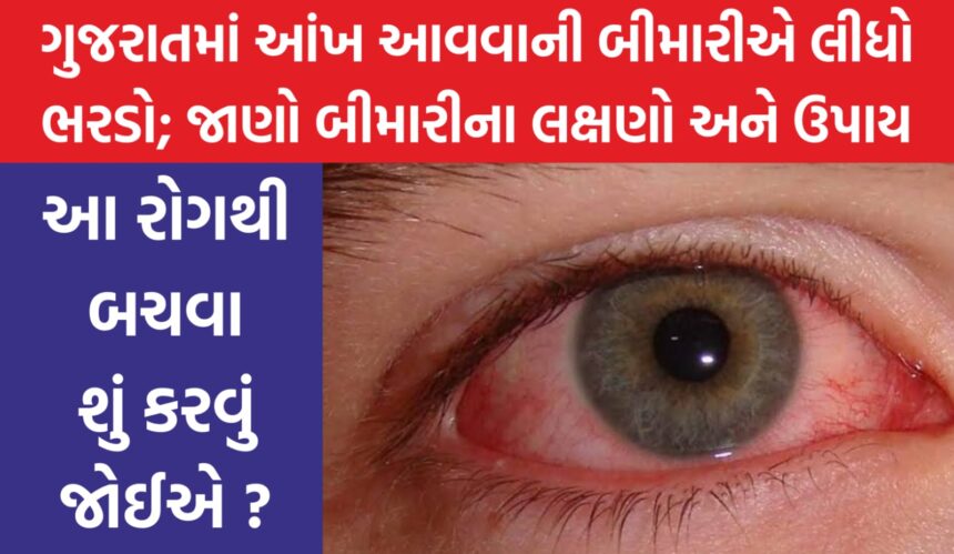 eye conjunctivitis